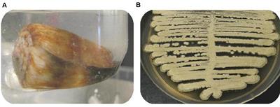 Diverse Cone-Snail Species Harbor Closely Related Streptomyces Species with Conserved Chemical and Genetic Profiles, Including Polycyclic Tetramic Acid Macrolactams